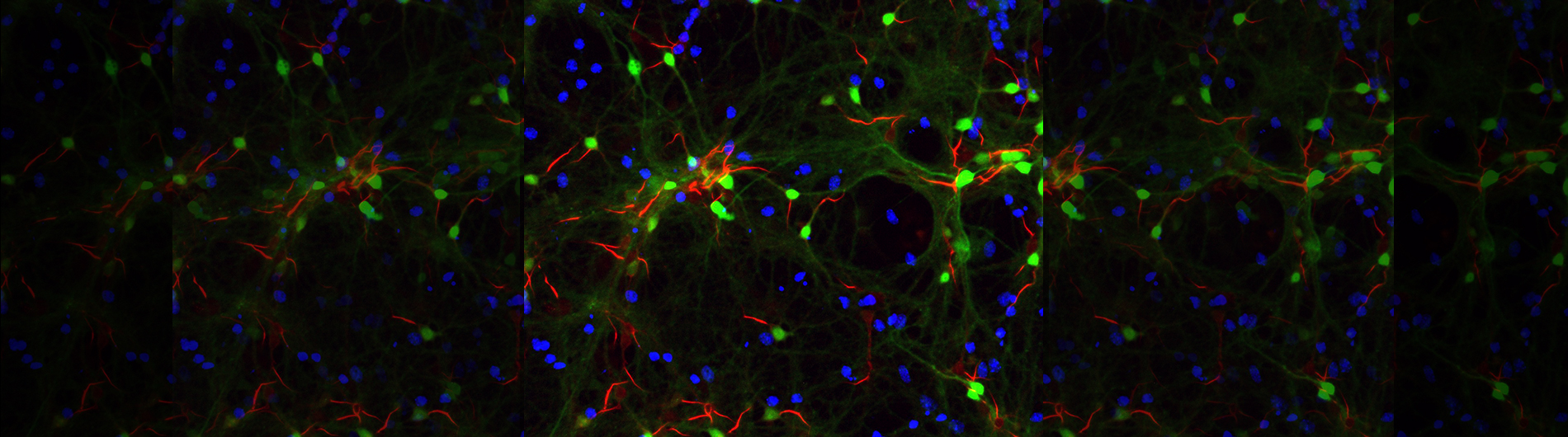 Ganguly Lab URMC & UR Research Laboratories University of Rochester
